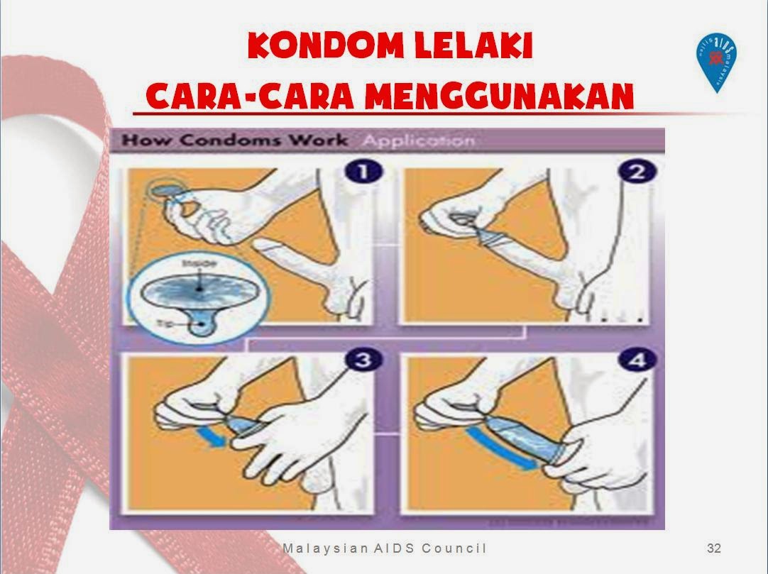  Cara  Yang  Benar  Memakai Kondom  Laki Laki ASRHYADI PLKB 