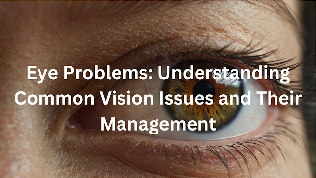 Eye Problems: Understanding Common Vision Issues and Their Management,eye issues,eye sight check,healthy life