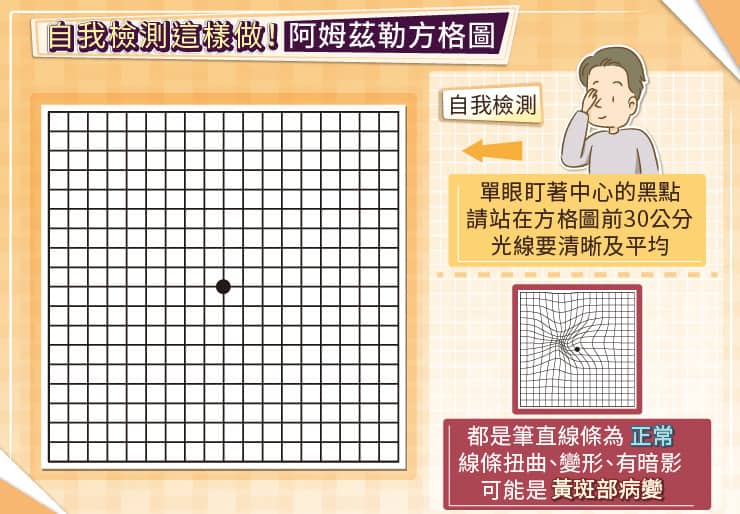 用阿姆茲勒方格圖(Amsler Grid)自我檢測