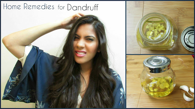 garlic, garlic oil, garlic oil for dandruff, garlic oil for hair growth, home-remedies, Home remedies for dandruff, home remedies for itchy scalp, how to treat dandruff at home, itchy scalp, beauty , fashion,beauty and fashion,beauty blog, fashion blog , indian beauty blog,indian fashion blog, beauty and fashion blog, indian beauty and fashion blog, indian bloggers, indian beauty bloggers, indian fashion bloggers,indian bloggers online, top 10 indian bloggers, top indian bloggers,top 10 fashion bloggers, indian bloggers on blogspot,home remedies, how to