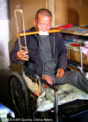#CODED-ish News::Photos: Man Hacks Off Infected Leg With A Saw Because He Could Not Afford Hospital Bills