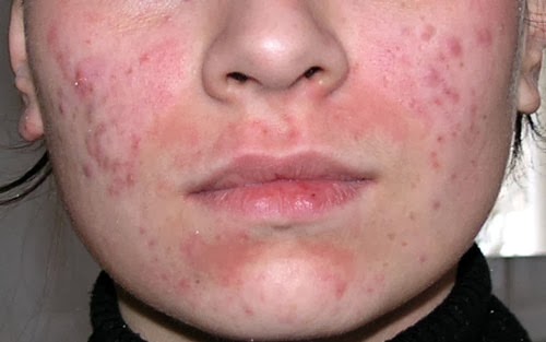 How to get rid of a rash on your face - simple recommendation