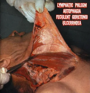 Split - Lymphatic Phlegm & Autophagia & Feculent Goretomb & Ulcerrhoea - 4 way split (2002)