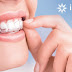 Quy trình niềng răng invisalign như thế nào?