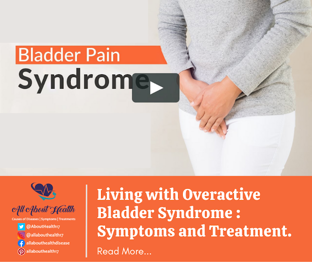 Living with Overactive Bladder Syndrome : Symptoms and Treatment.