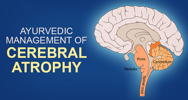 Ayurvedic management of cerebral atrophy