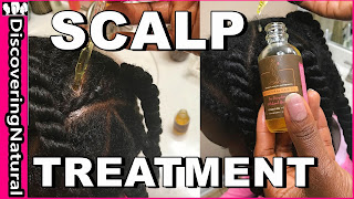 Scalp Treatment for Hair Growth | DiscoveringNatural