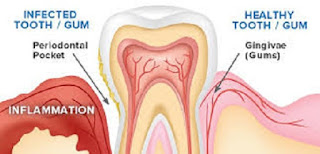 human teeth image