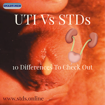 UTI Vs STD differences