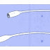 Cateterismo Vesical