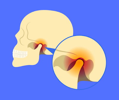 Chiropractor Ann Arbor, Ann Arbor Chiropractor