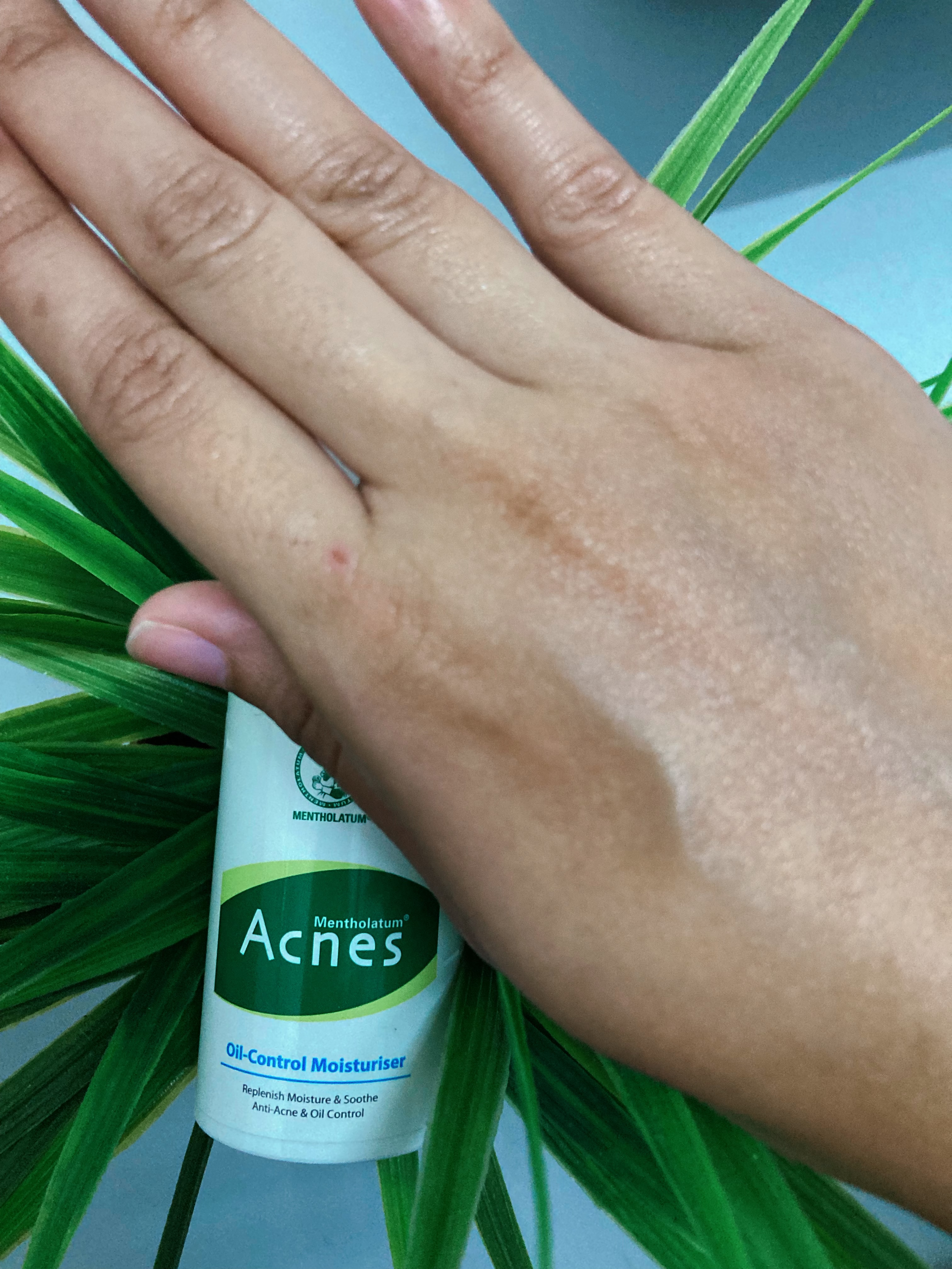 Mentholatum Acnes Moisturizer