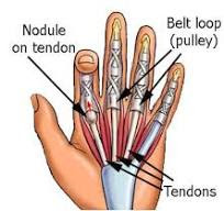 Trigger finger