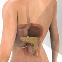 Does smoking cause pancreatic cancer