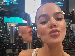 Khloe Kardashian Reveals She's Actually Has Bandage Wrap On Face From Tumor Removal 5 Months Prior