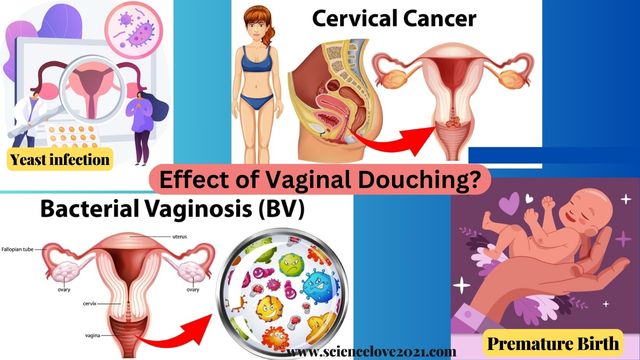 What is Vaginal Douching?: How to clean the uterus at home