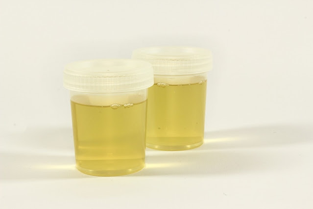 Want to Pass a Drug Test- Use Quick Fix Fake Urine