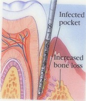 prognosis  definition