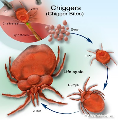 How to Prevent and Treat Chiggers 