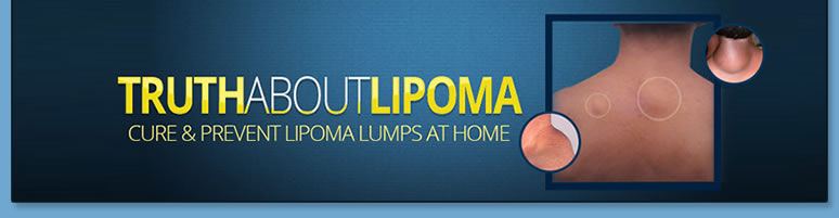 What Is Lipoma