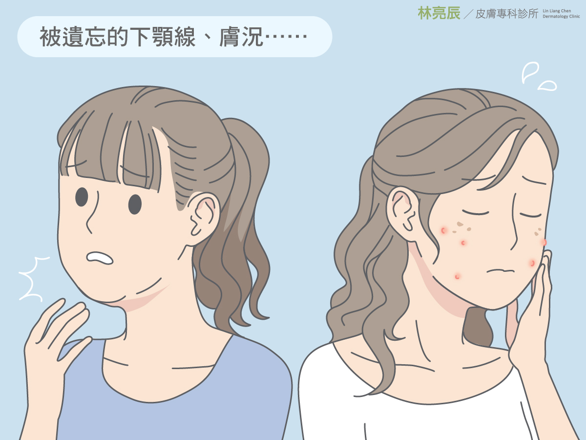 雙下巴難題:讓SculpSure絲酷秀還原下巴緊緻