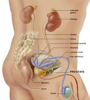 Images Prostate Cancer