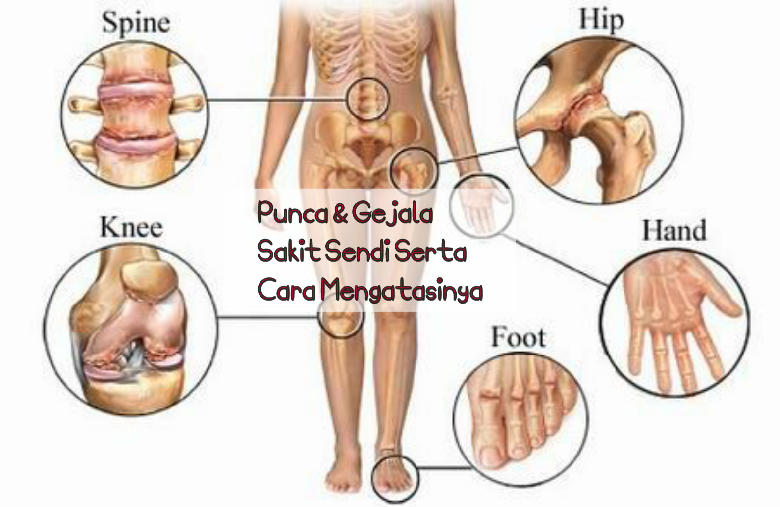 Punca Dan Gejala Sakit Sendi Serta Cara Untuk Mengatasinya