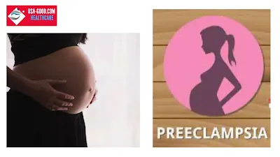 What Is Preeclampsia?