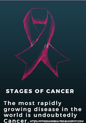 STAGES-OF-CANCER