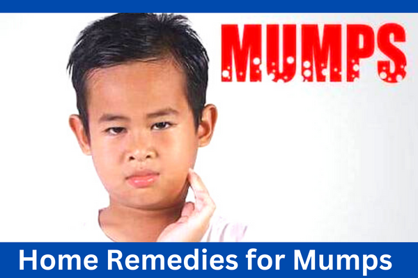 Home Remedies for Mumps