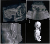 3d Ultra Sound6