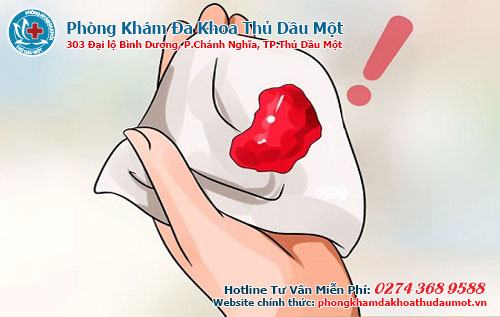 Ỉa ra máu là bệnh gì và có sao không