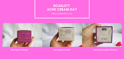 acne-cream-day-night-scarlett-whitening