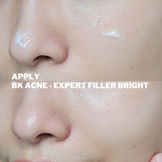 chortuang review BK acne expert filler bright pore ฟิลเตอร์ ผิวไบร์ท กระชับรูขุมขน ครีมซองลดสิว สยบทุกปัญหาสิว ผิวมัน รักษาสมดุลผิว