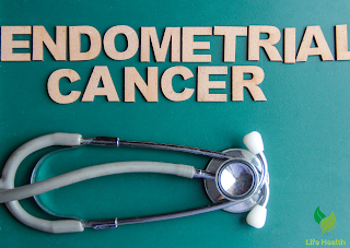 Unveiling the Enigma of Endometrial Cancer