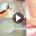 This Mixture Whitens Your Teeth, Eliminates Bad Brath, Tartar And Plaque