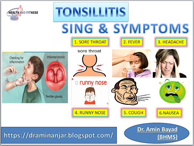 sing and symptoms of tonsillitis