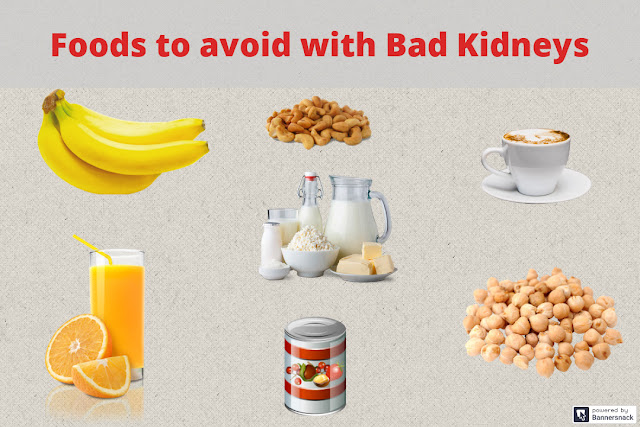 Foods to avoid with Bad Kidneys!