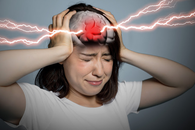 acupuncture migraine