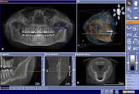 3d X ray