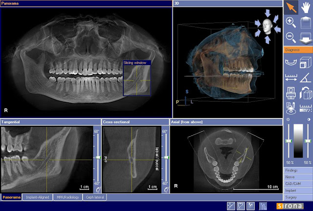 3d X ray