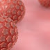Ο ιός των ανθρωπίνων θηλωμάτων (HPV) ευθύνεται για το 5,2% των καρκίνων