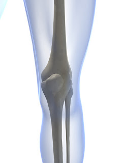 knee replacement, knee replacement hospital, knee replacement hospital in Ahmedabad