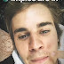Justin Bieber posts picture of his acne to instagram
