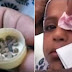 VIDEO: Mata Gadis ini Keluarkan Batu saat Menangis