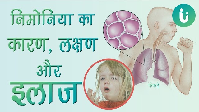 क्या है निमोनिया? जानें इसके लक्षण और कैसे करें इससे अपना बचाव