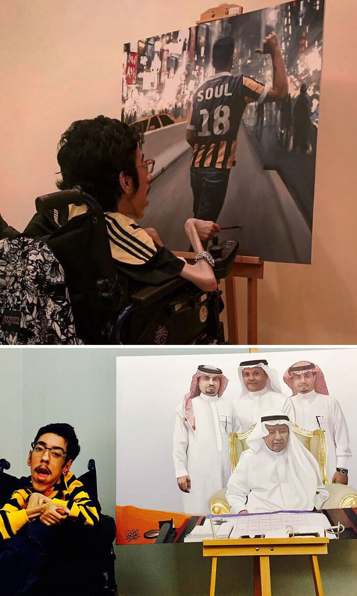 Artists Defy Their Disabilities And Create Amazing Works Of Art