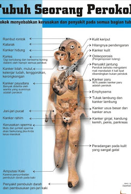 Bahaya Merokok bagi Kesehatan Tubuh, Wajib Tahu!