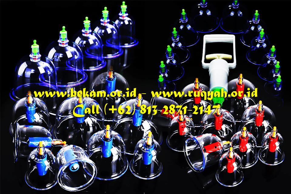 Wet Cupping Therapy Batam Center Bengkel Manusia Indonesia Call (+62) 813-2871-2147