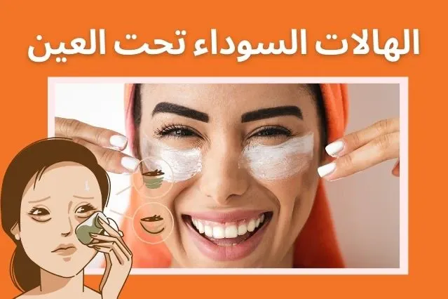 الهالات السوداء